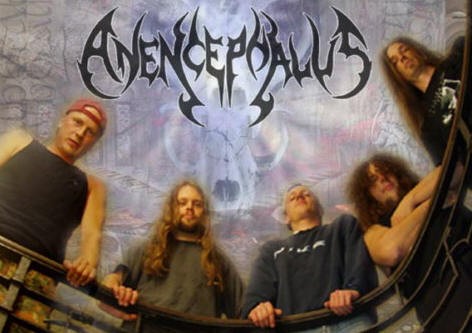Anencephalus