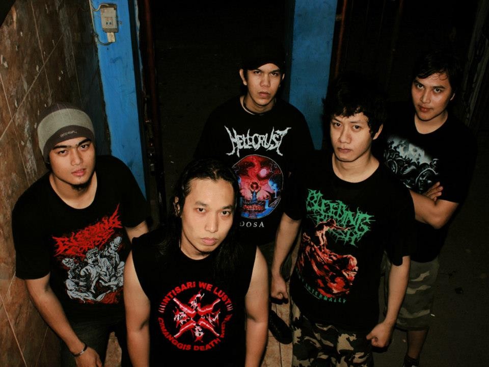 Antraks